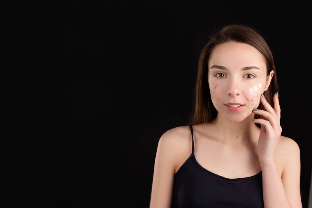 Teenage girl with acne applying skincare cream on face, isolated black background.