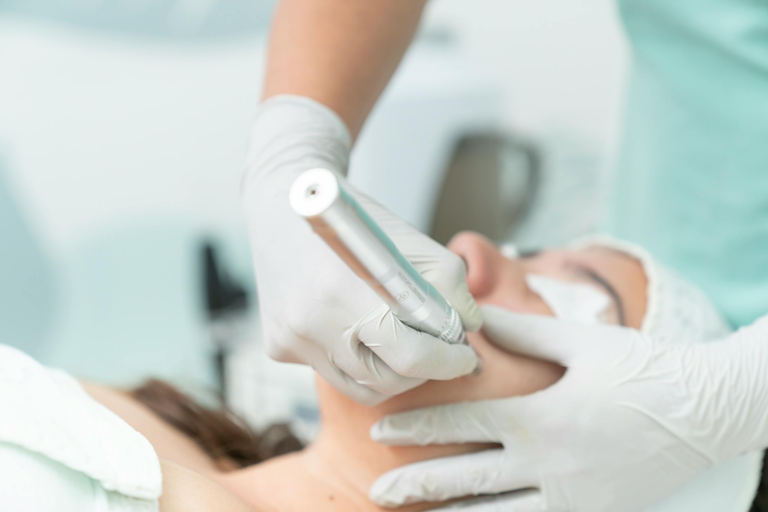 Close-up of a cosmetic treatment being performed in a clinical environment.